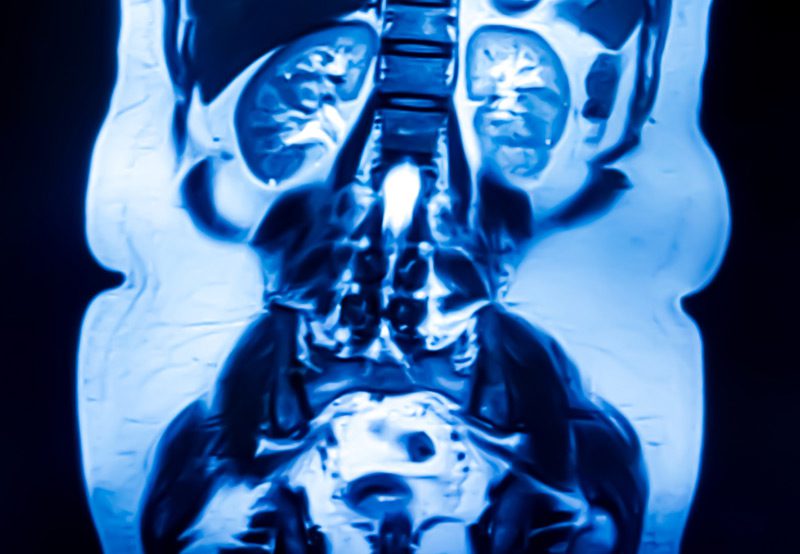 CT-urography-scan-highlighting-kidney-and-ureter CT-urography-scan-highlighting-kidney-and-ureter