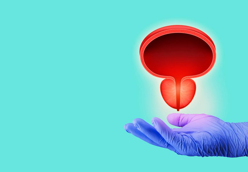 Clear-3-D-depiction-of-prostate-and-bladder