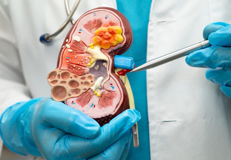 Doctor-hold-human-model-of-kidney-to-treat-and-study Doctor-hold-human-model-of-kidney-to-treat-and-study