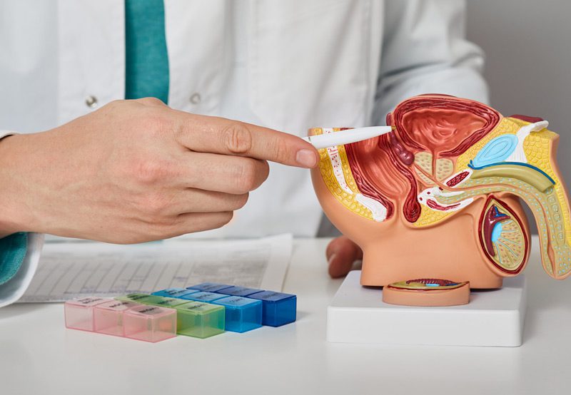 Doctor-pointing-to-model-of-prostate-gland
