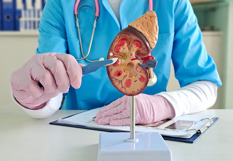 Doctor-showing-a-cross-section-model-of-the-kidney Doctor-showing-a-cross-section-model-of-the-kidney