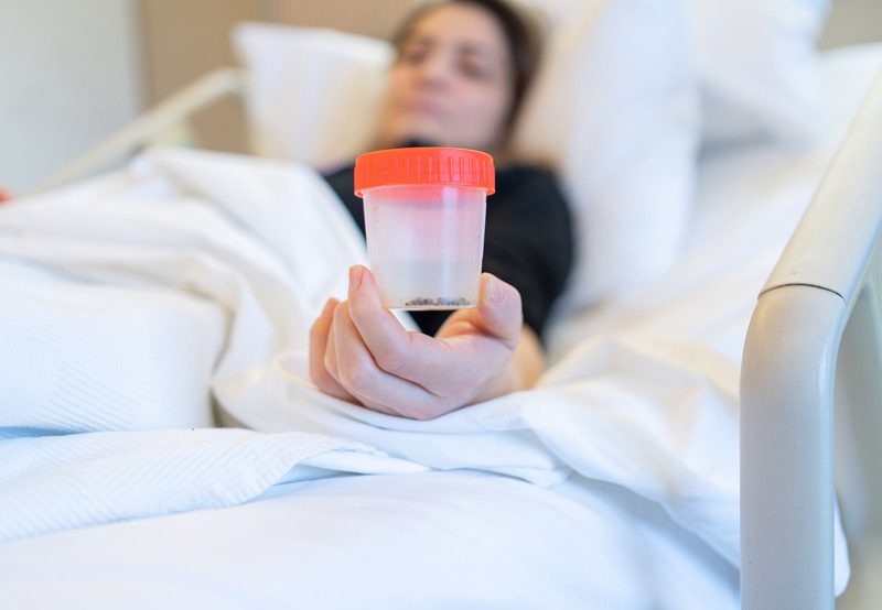 Female-patient-viewing-gallstones-after-surgery Female-patient-viewing-gallstones-after-surgery