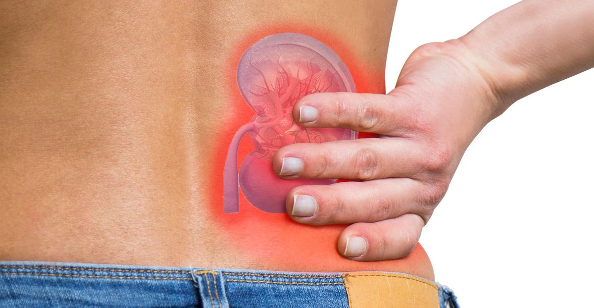 Kidney-pain-and-kidney-stone-illustration Kidney-pain-and-kidney-stone-illustration