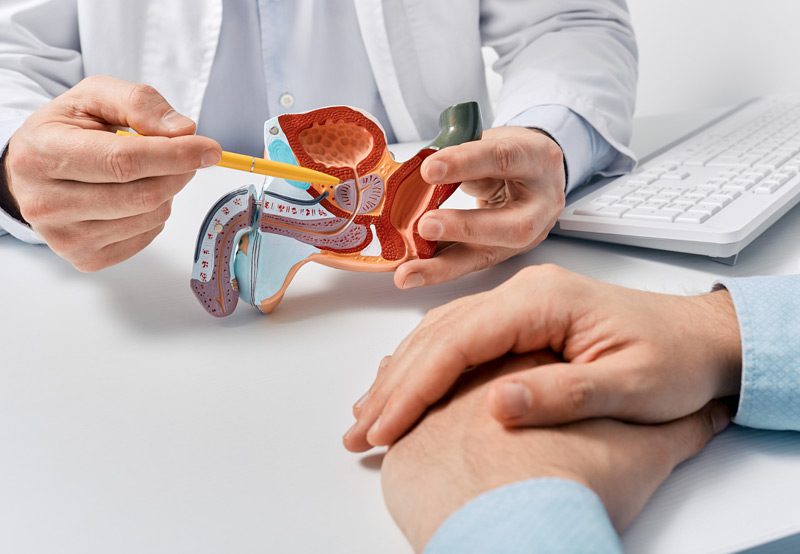 Male-reproductive-system-anatomical-model-in-doctor's-hands Male-reproductive-system-anatomical-model-in-doctor's-hands