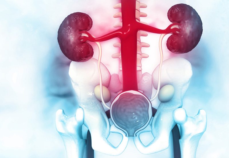 Medical-illustration-showing-the-ureteropelvic-junction-obstruction Medical-illustration-showing-the-ureteropelvic-junction-obstruction