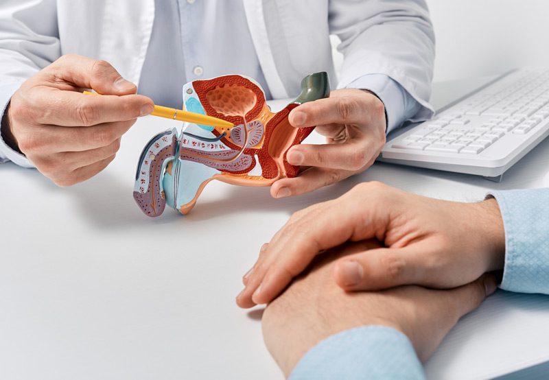 Prostate-disease-and-treatment-model Prostate-disease-and-treatment-model