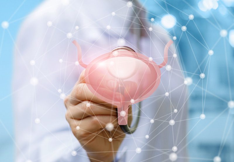 The-concept-of-treatment-of-the-bladder The-concept-of-treatment-of-the-bladder
