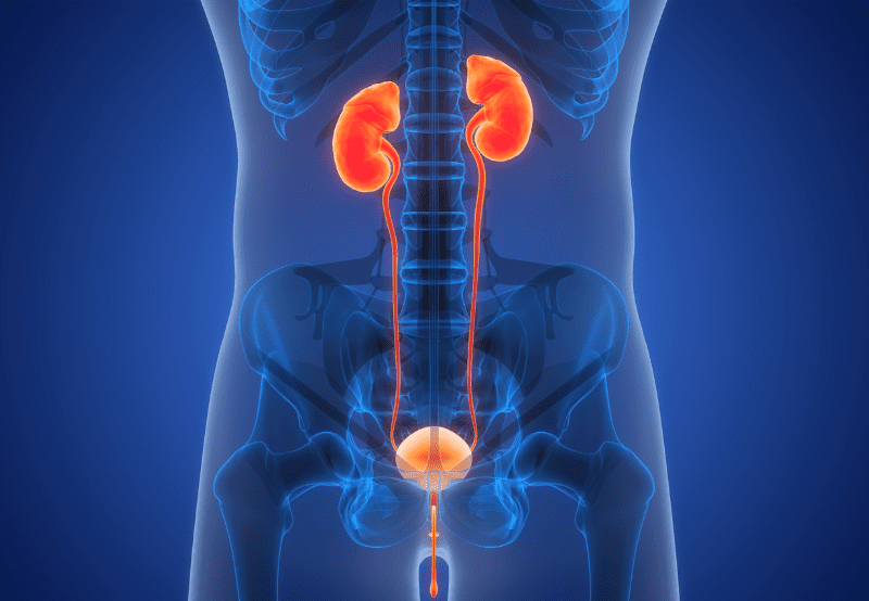 ureteropelvic junction obstruction